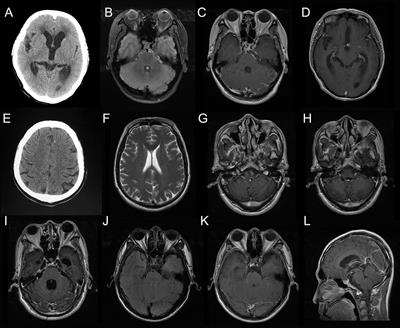 Next-Generation Sequencing of Cerebrospinal Fluid for the Diagnosis of Neurocysticercosis